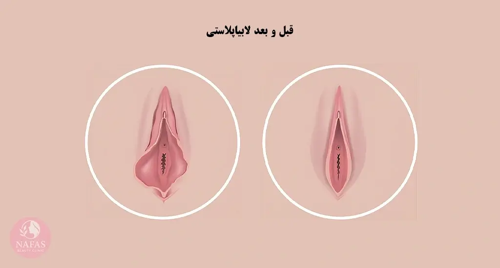 تصویر