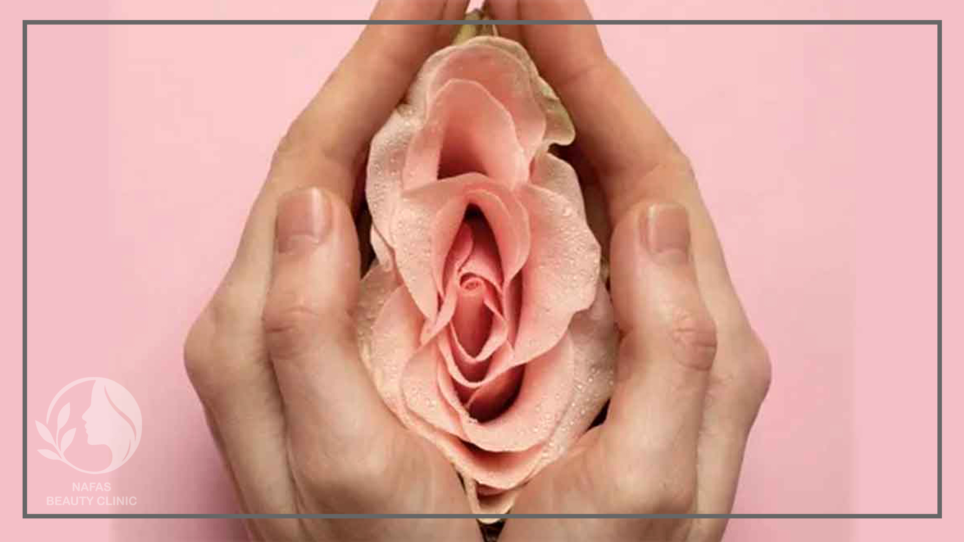 لابیاپلاستی