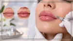 کانتورینگ لب با ژل